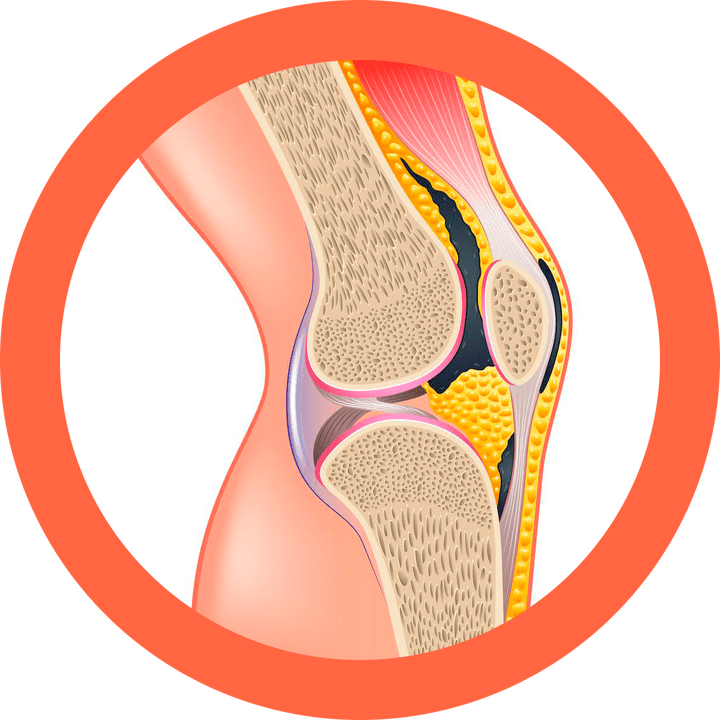 Hondroteno restaura as articulacións e os músculos