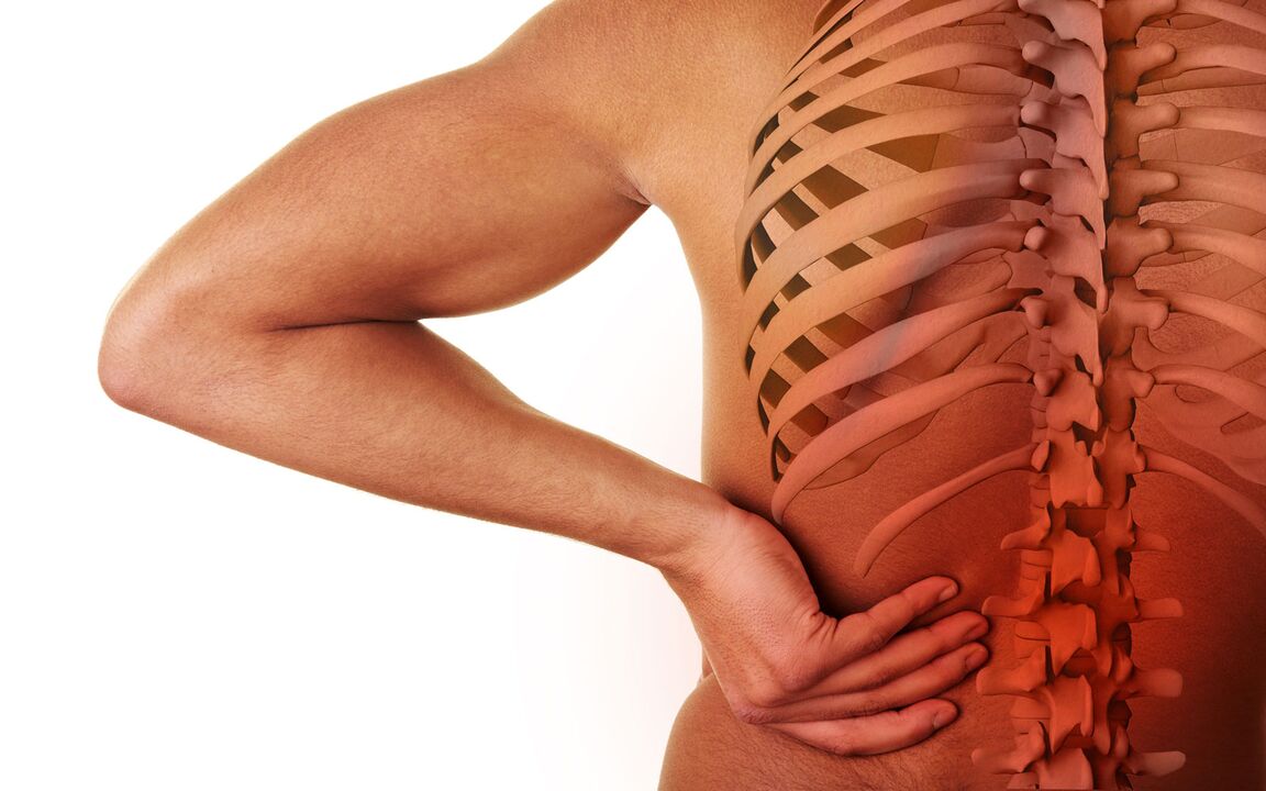 Síntomas da osteocondrose lumbar